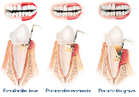 parodontologia