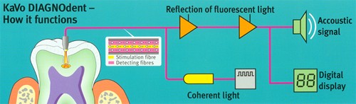 funzionamento diagnosi strumentale