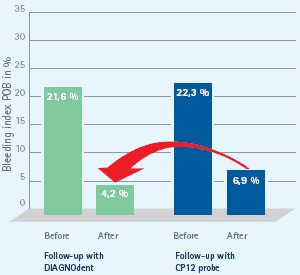 grafico sansuinamento