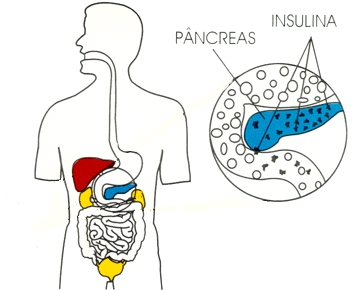 il diabete mellito