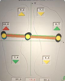 diagnosi a laser